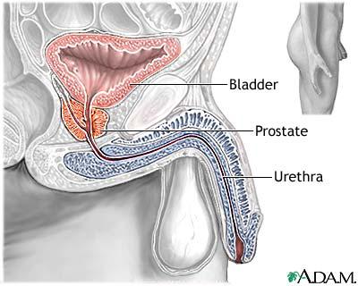 Medic prostata dan mischianu