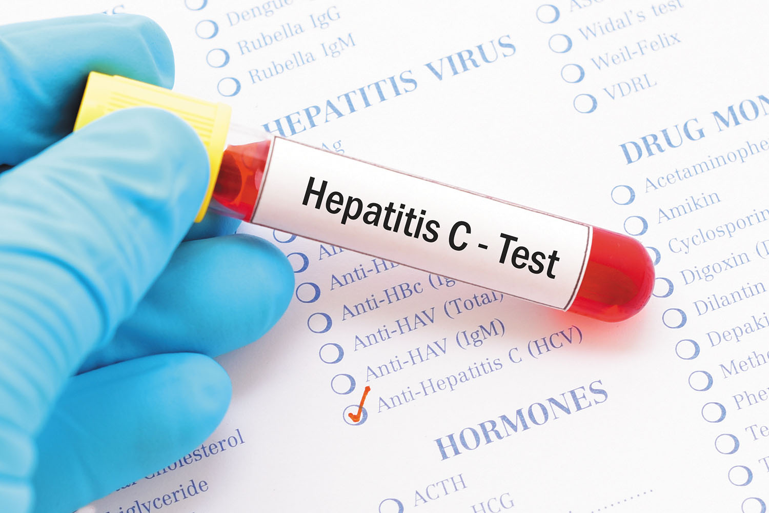 how long to wait to get tested for hepatitis c