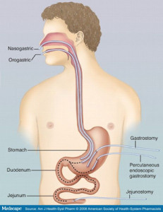 Source: https://www.google.com/url?sa=i&rct=j&q=&esrc=s&source=images&cd=&cad=rja&docid=likmHbuZP9U1eM&tbnid=cbWP7L_VPiR-qM:&ved=0CAEQjxw&url=http%3A%2F%2Fwww.medscape.com%2Fviewarticle%2F585397_2&ei=Vu5LUoaRIoGNrgeMsIDgBw&psig=AFQjCNGGvx5N5BsrtAT7HtWHFJqk6FaHaA&ust=1380794316539249