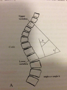 Pengiraan 'Cobb's Angle' Sumber: Spine Secrets, Vincent J. Devlin, page 67.