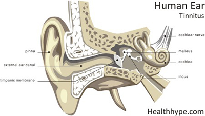 tinnitus_ear_ringing