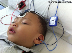 A sedated child undergoing ASSR hearing test. He needs to be fully relaxed for this test