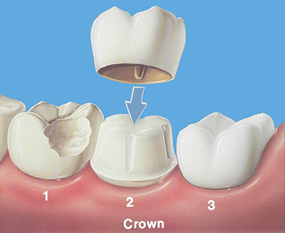 Source: : http://strathconadental.ca