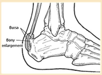 Source: ortho.com.sg