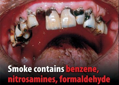 Source: http://pediatricdentists.blogspot.com.au