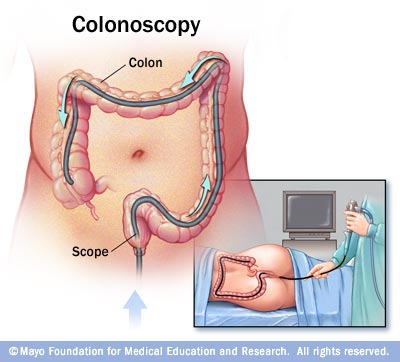 Sumber: http://greatlakesgastroenterology.com