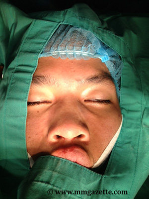 Imej 7,8 &9: pandangan hadapan, sisi & atas selepas pembedahan.