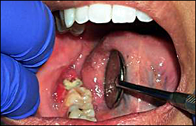 Sumber: www.dentalcare.com