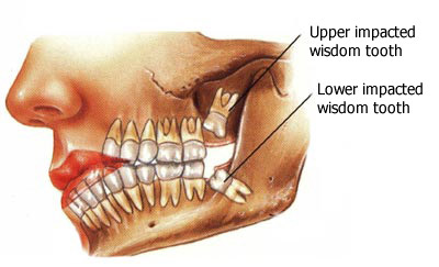 Sumber: www.systemicdentist.com 