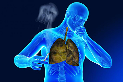man-coughing-with-cigarette-in-his-hand
