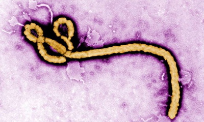 Ebola