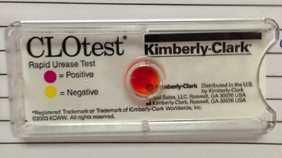 Figure 4: Pictures showing a rapid detection kit aptly named CLOtest manufactured by Kimberly-Clark for the Helicobacter pylori bacterium as the colour turns from yellow to red. The time taken to turn positive can be rather immediate depending on the severity of the infection, but it can take up to 30-60 minutes for the results to be conclusive.