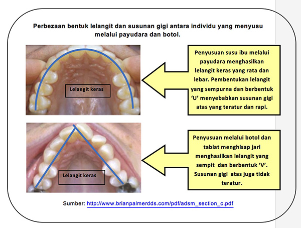 dental2