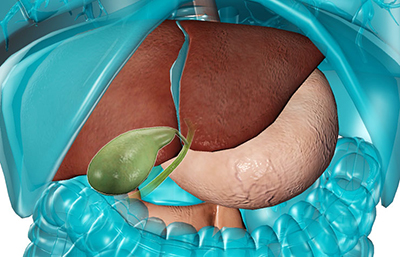 gallbladder-surgery-for-gall-stones-preview