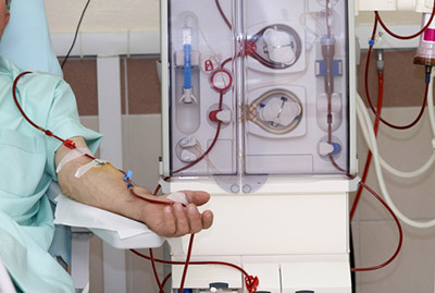 Haemodialysis