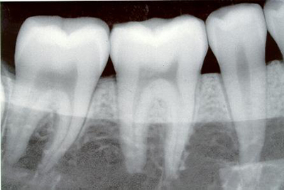 dental-x-ray